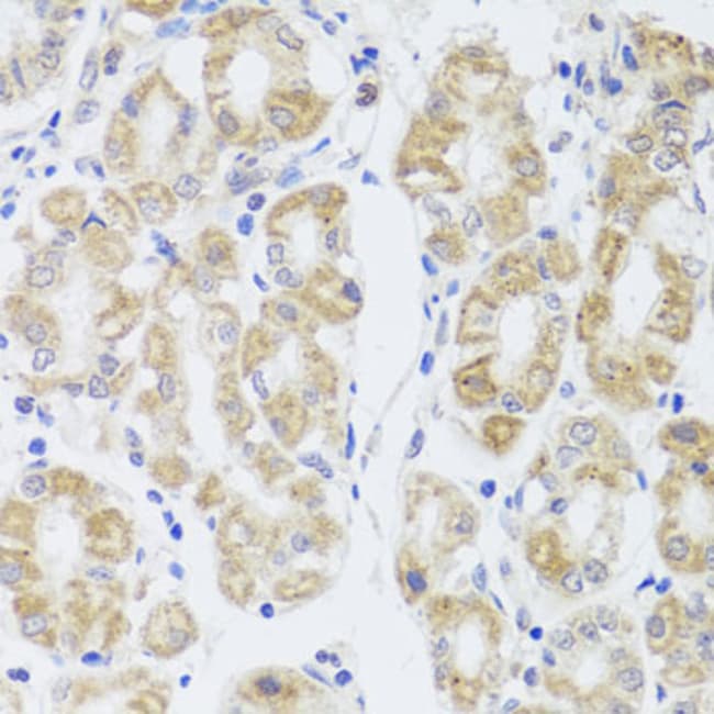 100UL AQUAPORIN 0 ANTIBODY 100 UL
