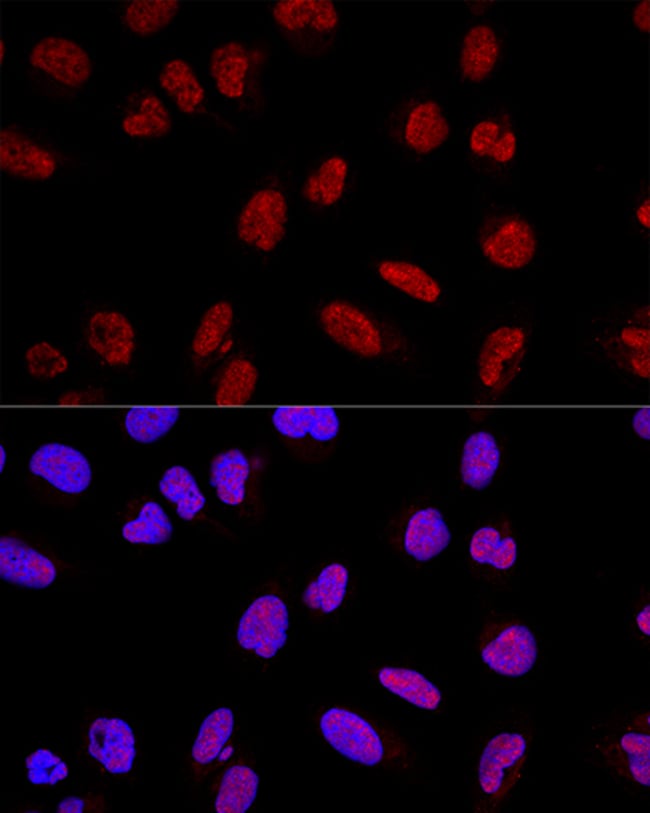 100UL AKAP8 ANTIBODY 100 UL