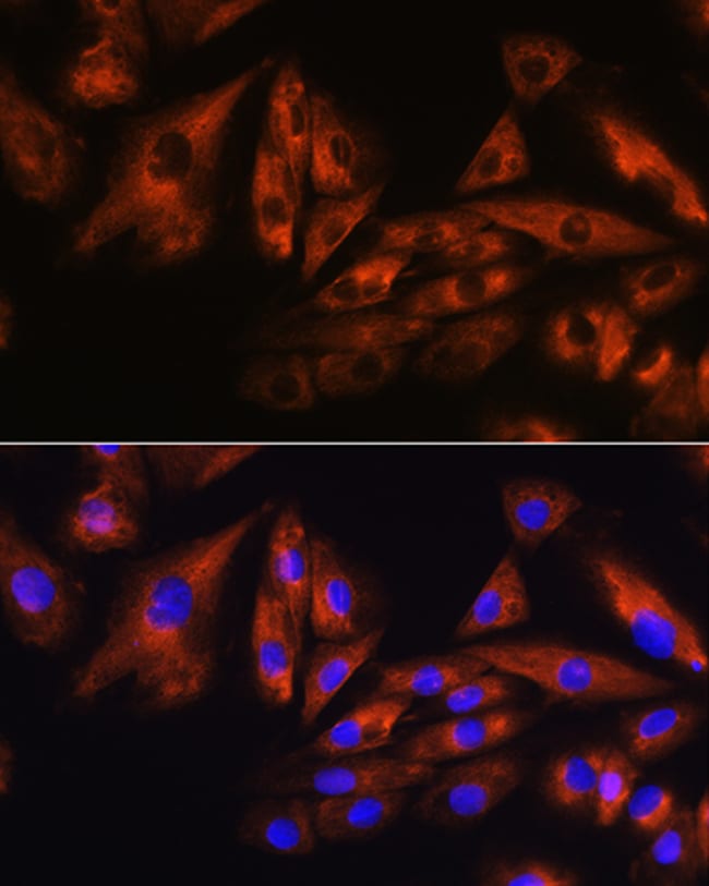 100UL ATXN10 ANTIBODY 100 UL