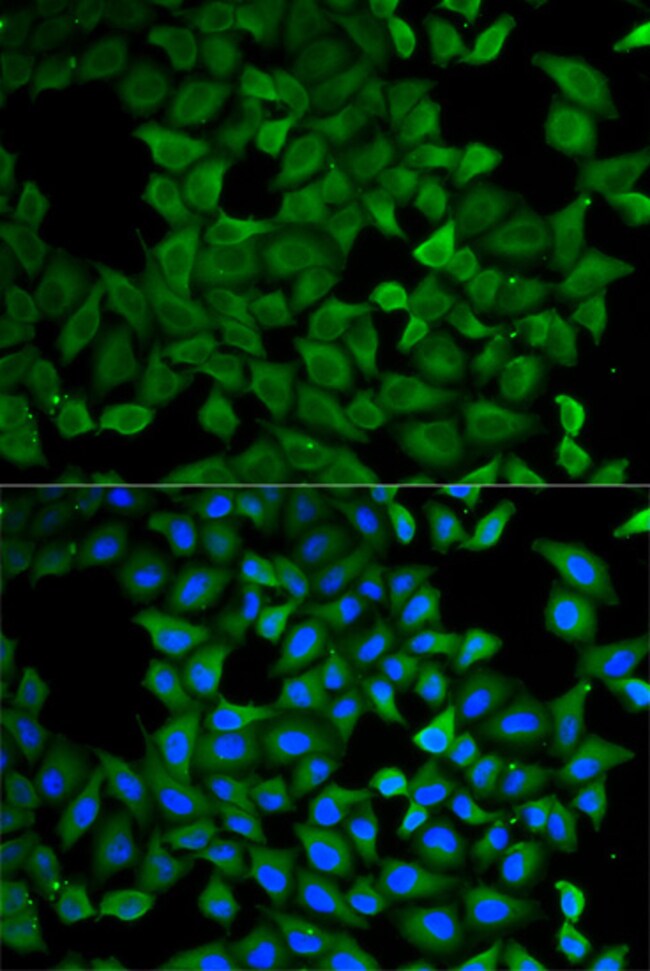 100UL ATL1 ANTIBODY 100 UL