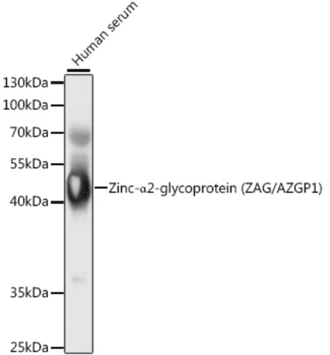 100UL AZGP1 ANTIBODY 100 UL