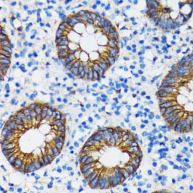 100UL ALPHA CATENIN ANTIBODY 100 UL