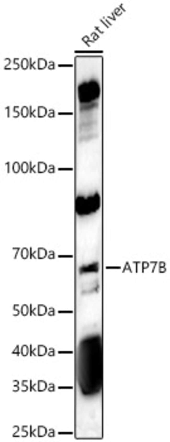 100UL ATP7B ANTIBODY 100 UL