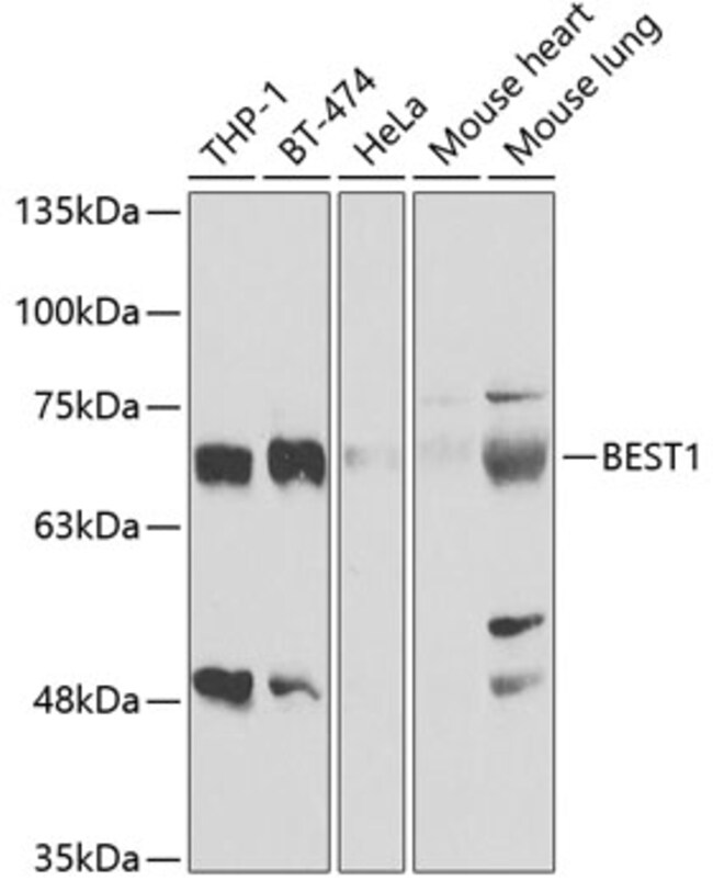 100UL BESTROPHIN 1 ANTIBODY 100 UL