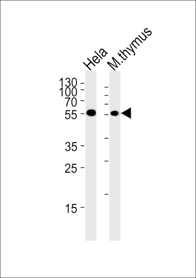 ANTI-CHK1, 0,1 MG