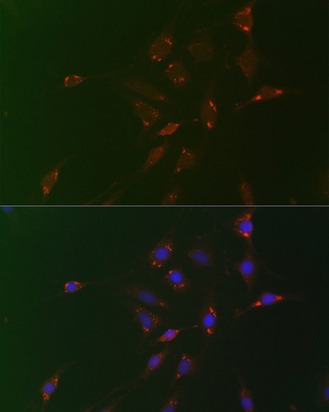 100UL ADFP ANTIBODY 100 UL