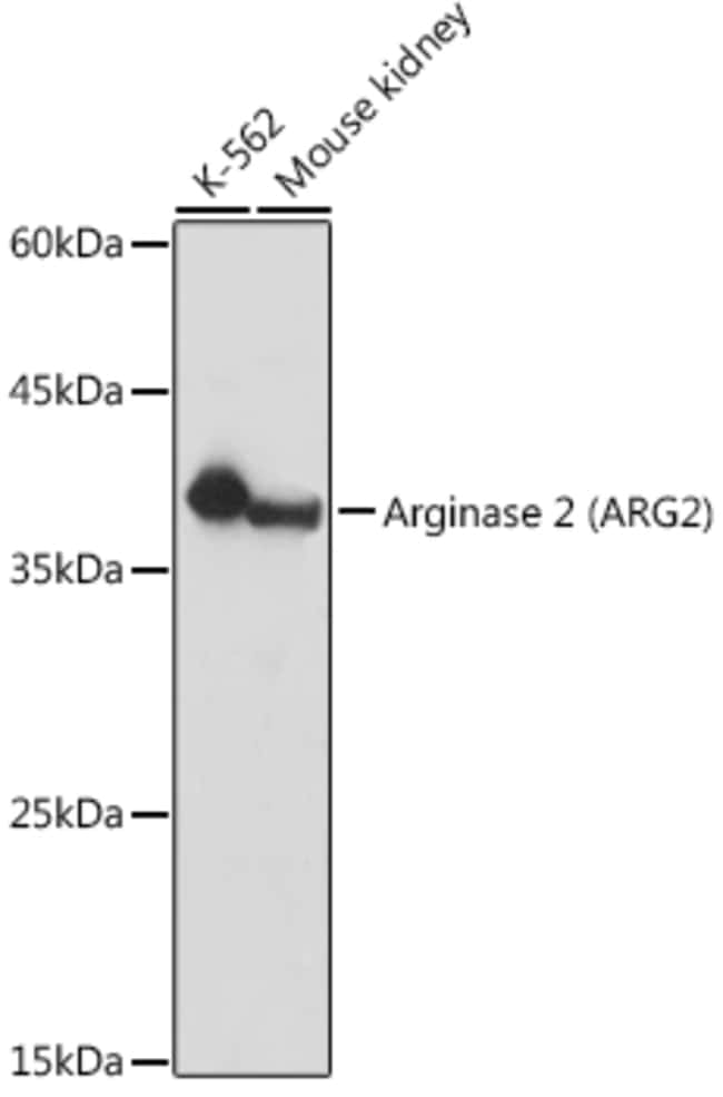 100UL ARGINASE 2 ANTIBODY 100 UL