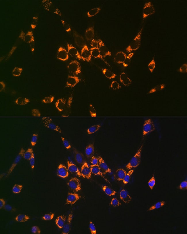 100UL ASL ANTIBODY 100 UL