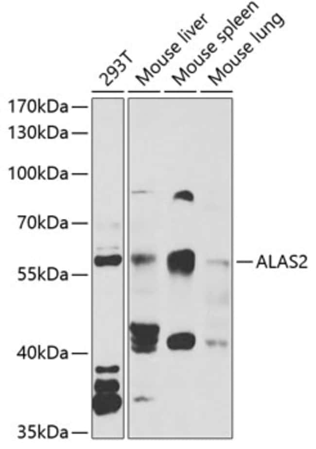 100UL ALAS2 ANTIBODY 100 UL