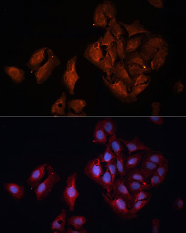 100UL BAP1 ANTIBODY 100 UL