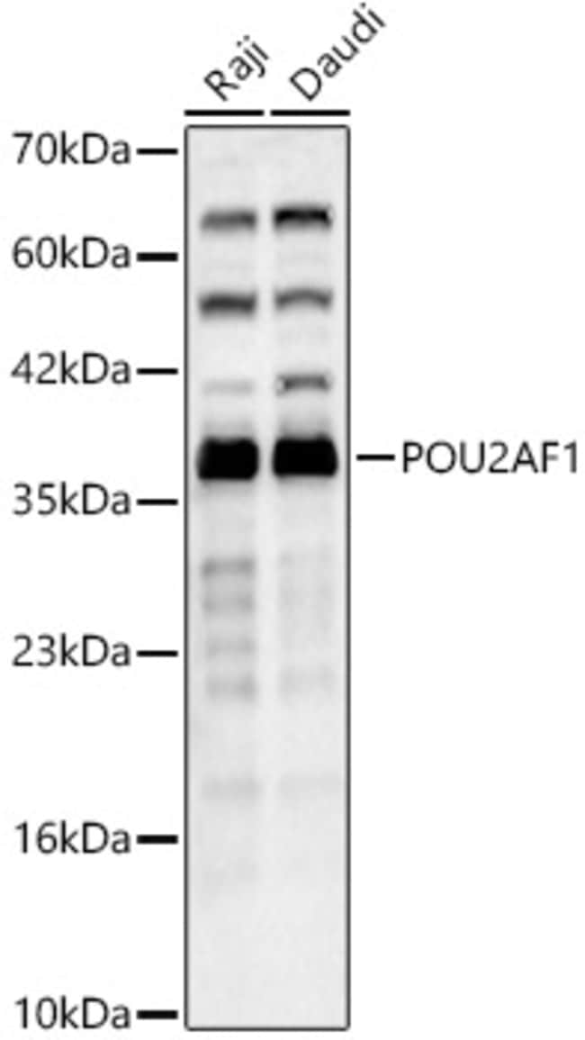 100UL BOB-1 ANTIBODY 100 UL
