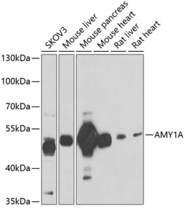 100UL ALPHA AMYLASE 1 ANTIBODY 100 UL