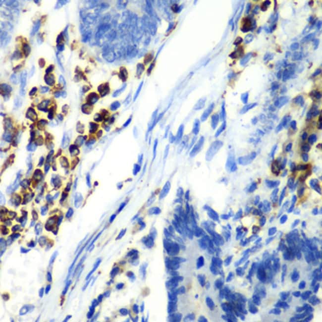 100UL ASGR1 ANTIBODY 100 UL