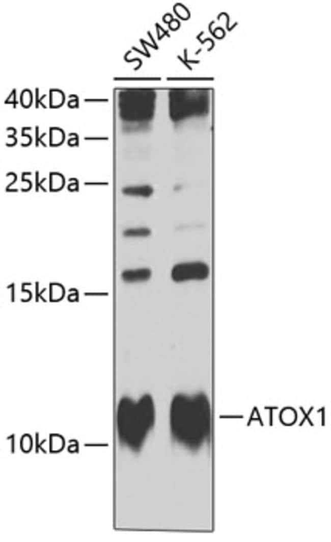 100UL ATOX1 ANTIBODY 100 UL