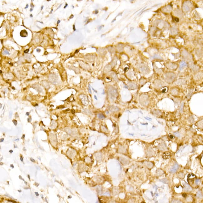 100UL AP3B1 ANTIBODY 100 UL