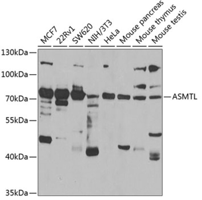 100UL ASMTL ANTIBODY 100 UL