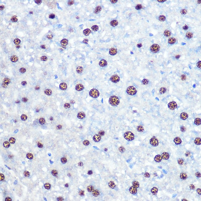 100UL APIP ANTIBODY 100 UL