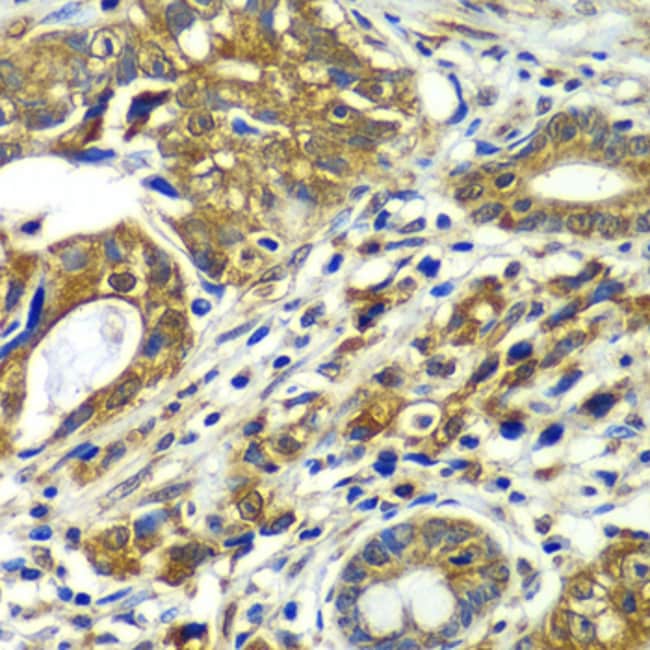 100UL APC6 ANTIBODY 100 UL