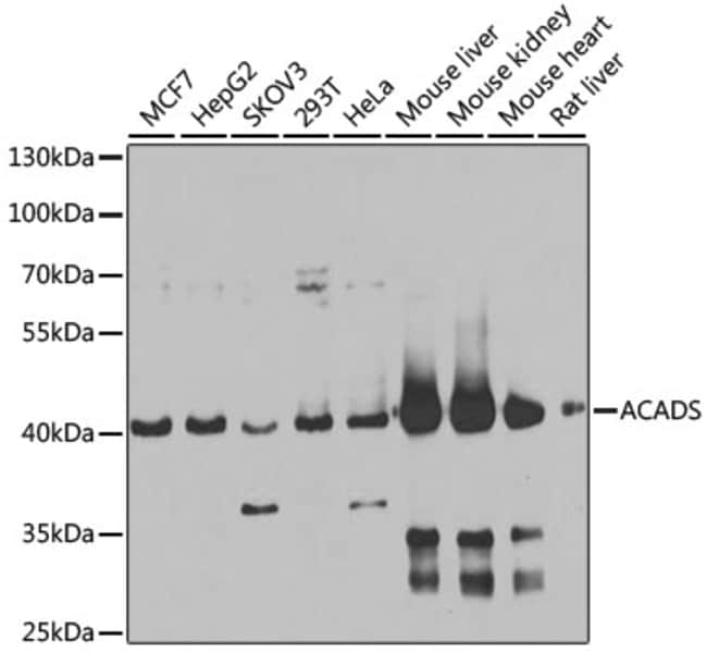 100UL ACADS ANTIBODY 100 UL