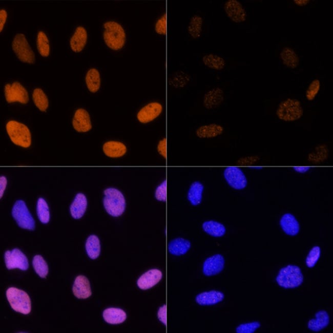 100UL ACETYL-HISTONE H3 ANTIBODY 100 UL