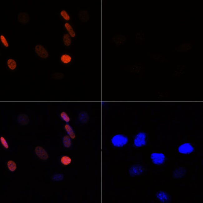 100UL ACETYL-HISTONE H3 ANTIBODY 100 UL