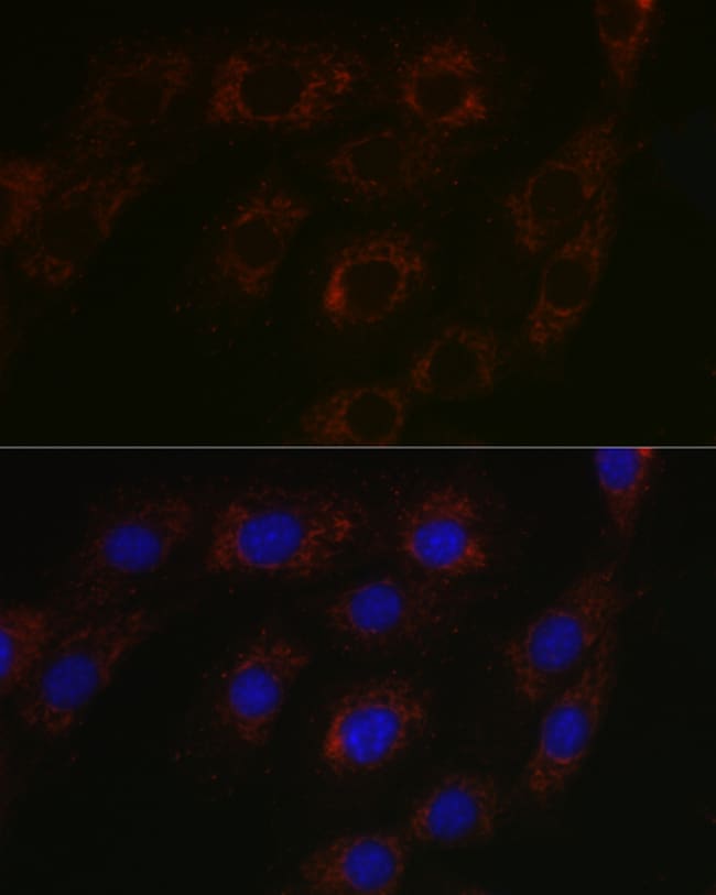 100UL BCAT2 ANTIBODY 100 UL