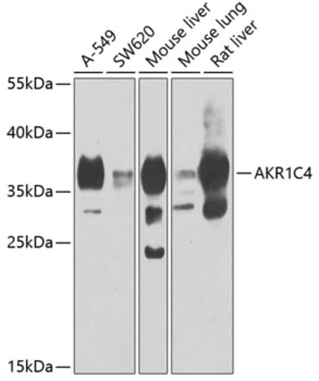 100UL AKR1C4 ANTIBODY 100 UL