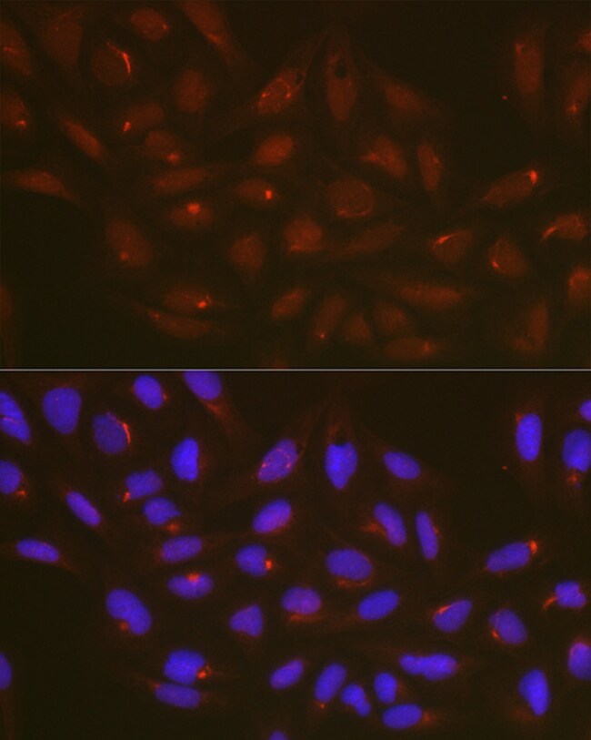 100UL ATG14 ANTIBODY 100 UL
