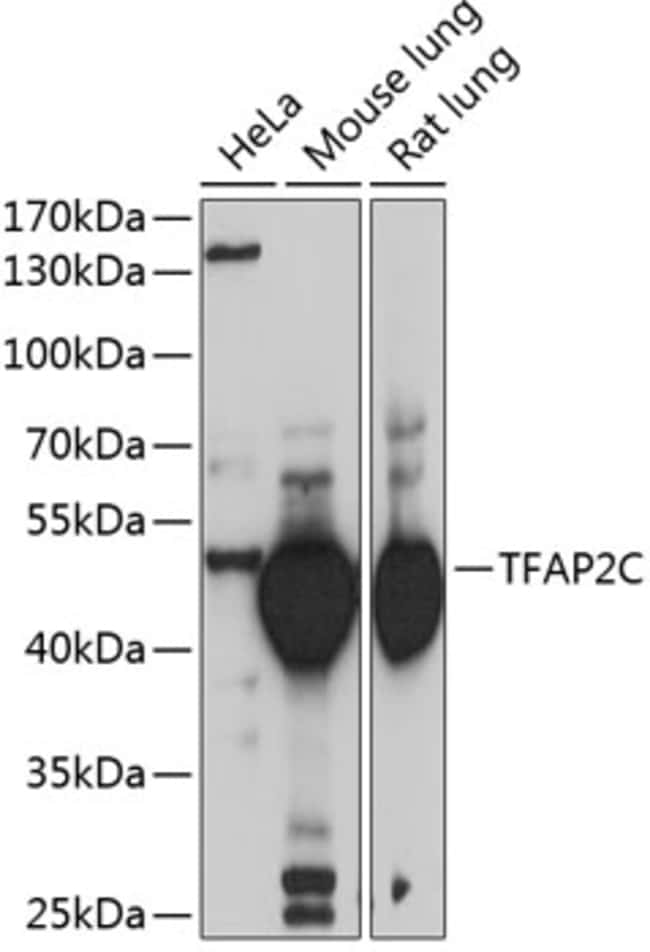 100UL AP2 GAMMA ANTIBODY 100 UL
