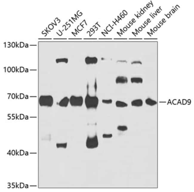 100UL ACAD9 ANTIBODY 100 UL