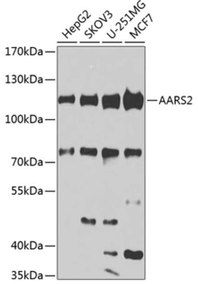 100UL AARS2 ANTIBODY 100 UL