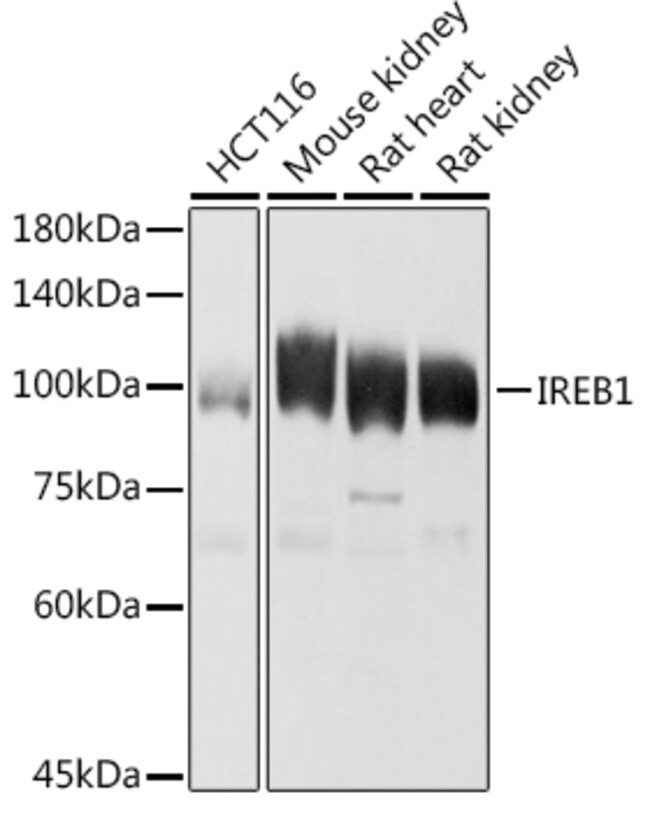 100UL ACONITASE 1 ANTIBODY 100 UL