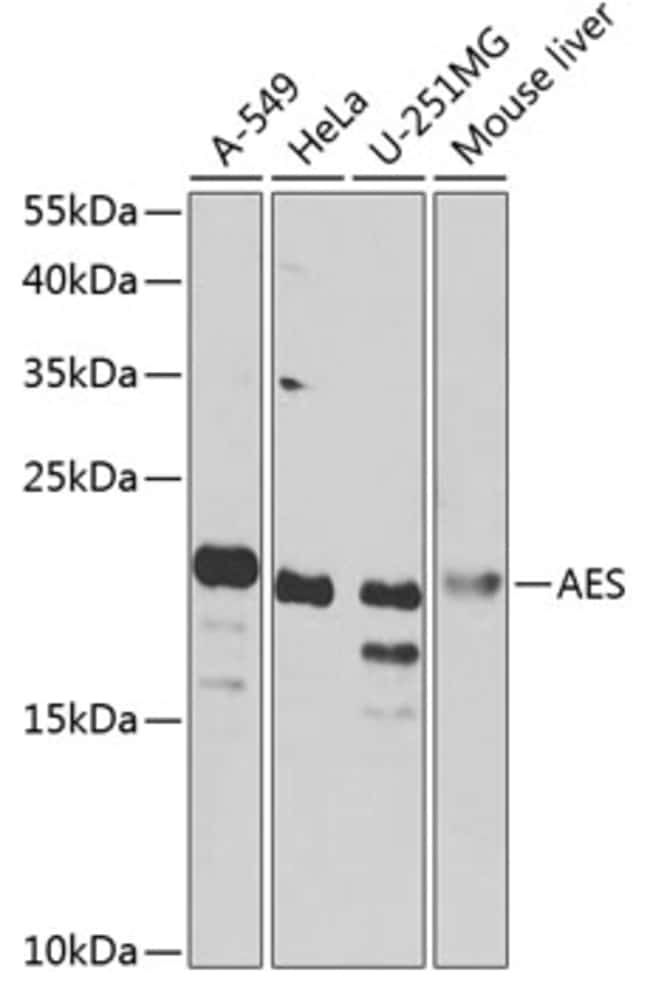 100UL AES ANTIBODY 100 UL