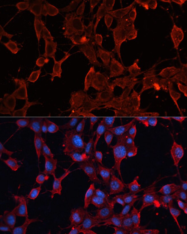 100UL ADAM12 ANTIBODY 100 UL