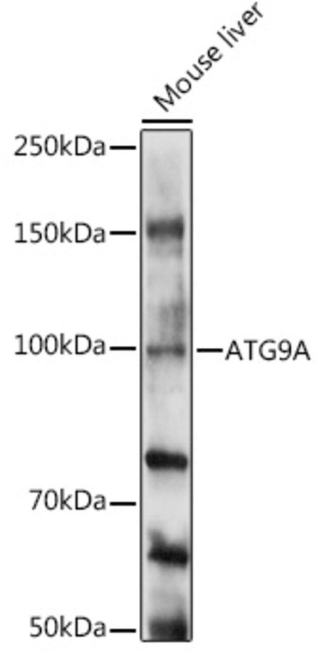 100UL ATG9A ANTIBODY 100 UL