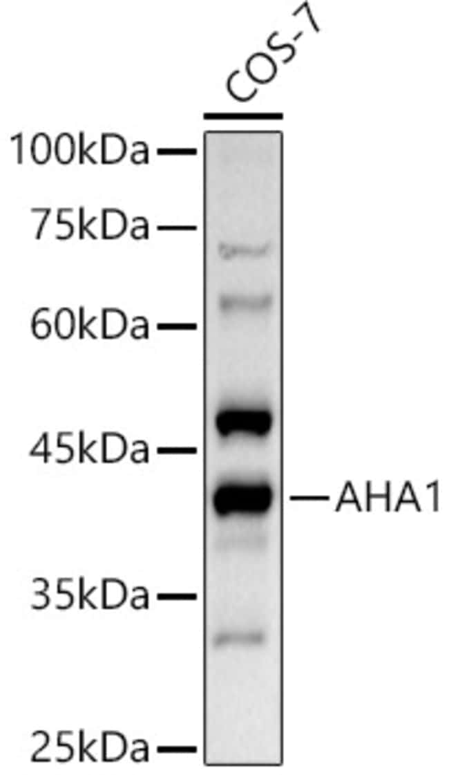 100UL AHA1 ANTIBODY 100 UL