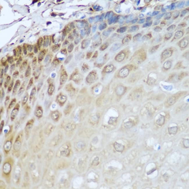 100UL ALCOHOL DEHYDROGENASE 1C ANTIB 100