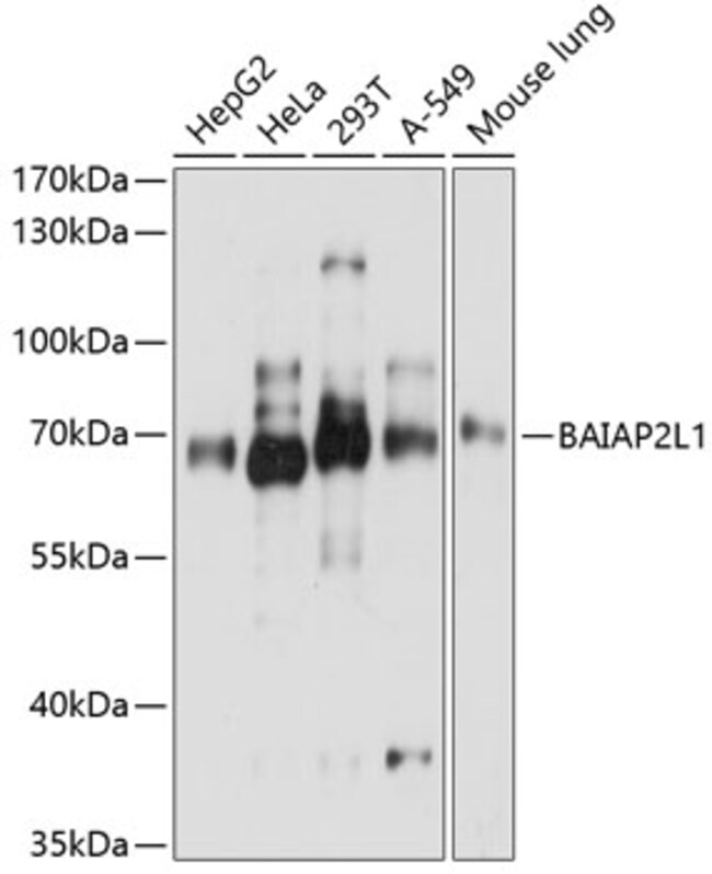 100UL BAIAP2L1 ANTIBODY 100 UL