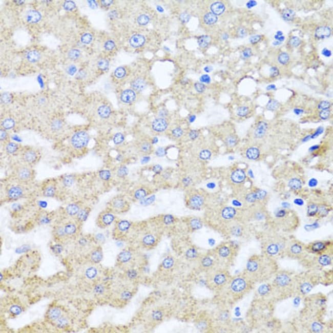 100UL ARL6 ANTIBODY 100 UL