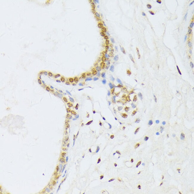 100UL ANR52 ANTIBODY 100 UL