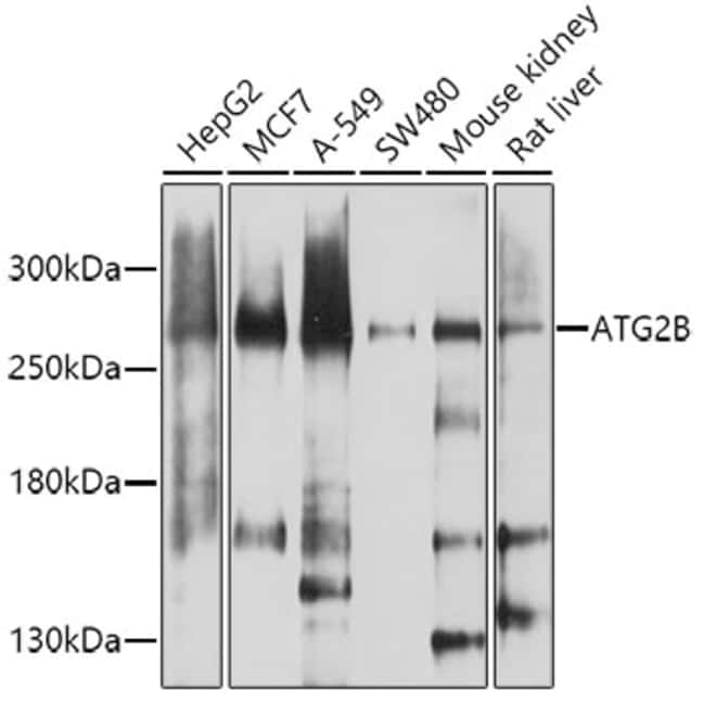 100UL ATG2B ANTIBODY 100 UL