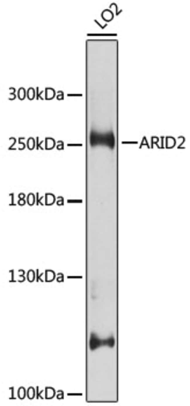 100UL ARID2 ANTIBODY 100 UL