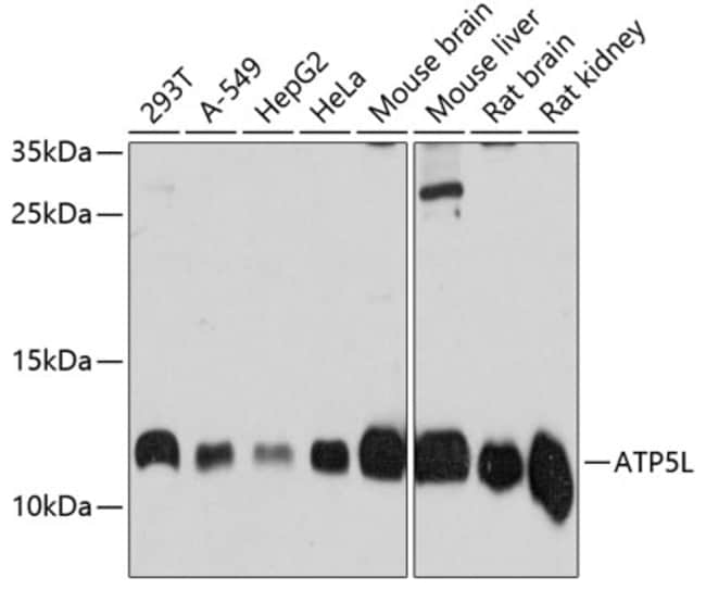 100UL ATP5L ANTIBODY 100 UL