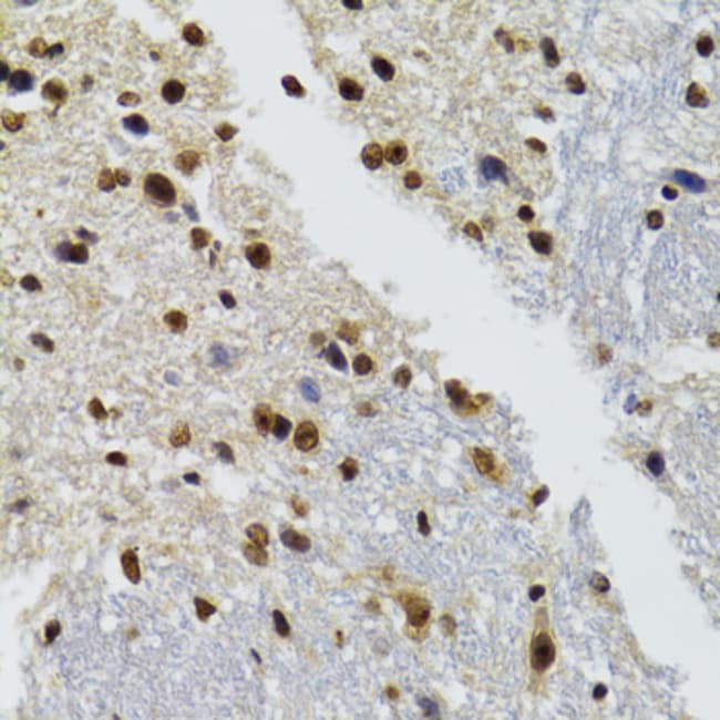 100UL BAZ1B ANTIBODY 100 UL