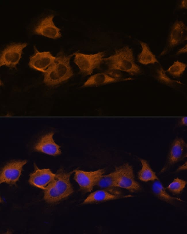 100UL ATP1B2 ANTIBODY 100 UL