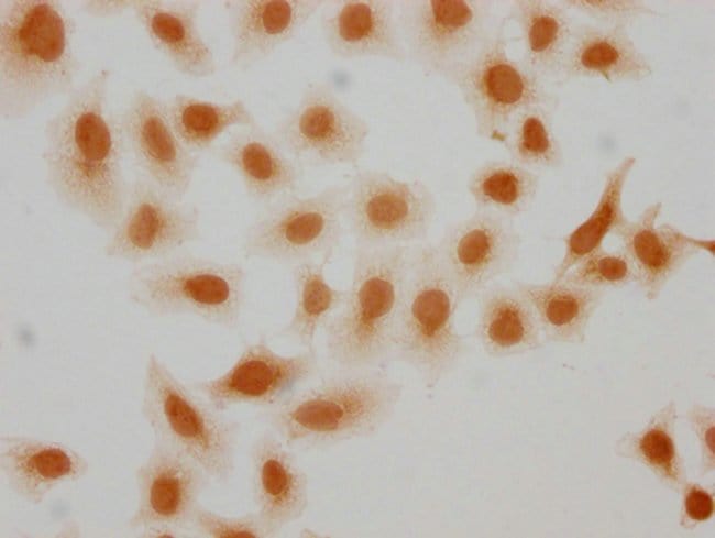 100UL 2-HYDROXYISOBUTYRYL-HIST1H2AG 100U