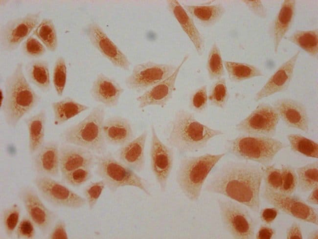 100UL 2-HYDROXYISOBUTYRYL-HISTONE H4 100