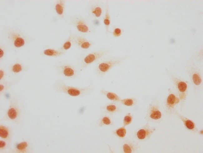 100UL 2-HYDROXYISOBUTYRYL-HISTONE H4 100