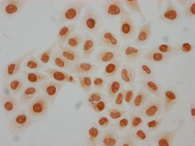 100UL 2-HYDROXYISOBUTYRYL-HISTONE H4 100
