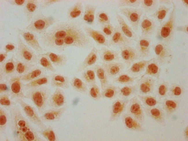 100UL 2-HYDROXYISOBUTYRYL-HISTONE H4 100